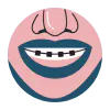 Braces