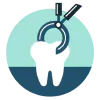 Tooth Extraction